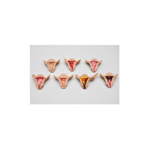 Матка, нормальная и с внутренними патологиями, доп. комплектация для W45043 — купить в МЕДСЕТ