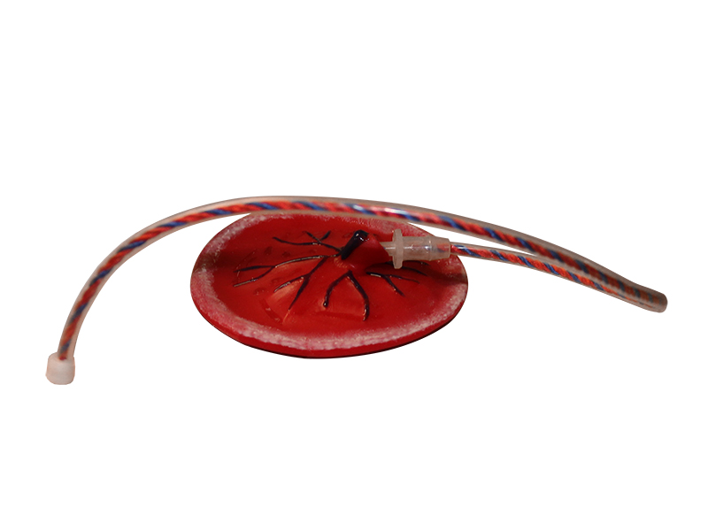 Плацента с пуповиной — купить в МЕДСЕТ