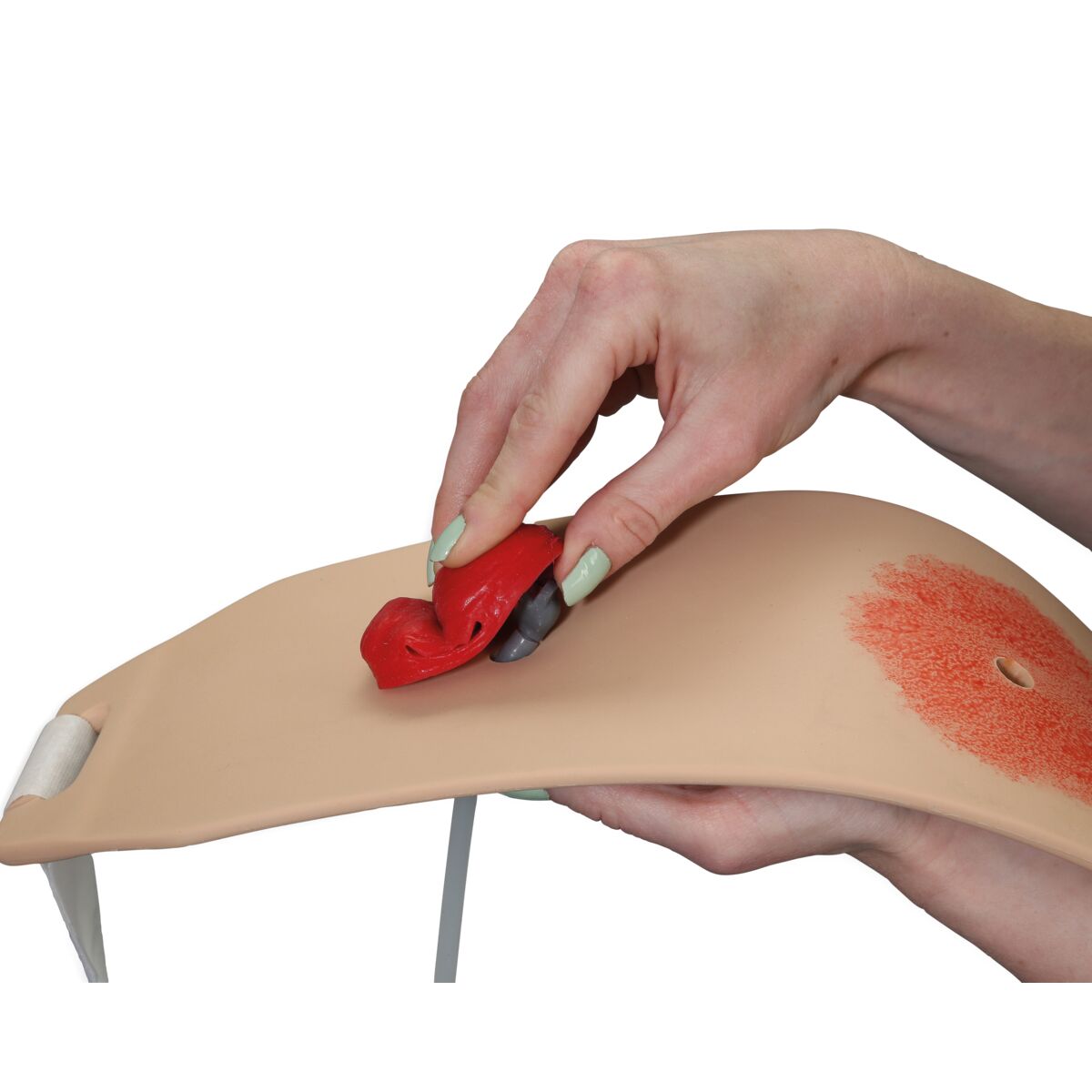 Пояс/тренажер для наложения стомы, светлая кожа — купить в МЕДСЕТ