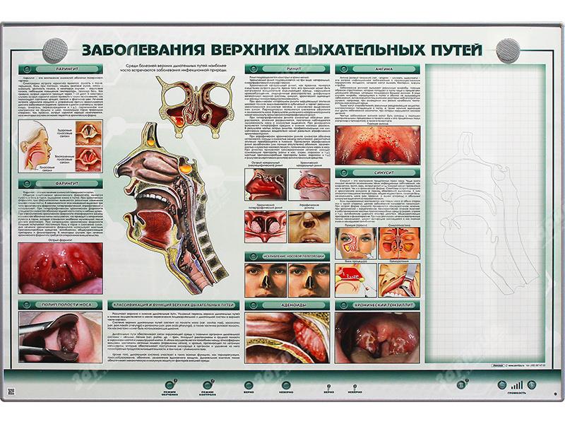 Интерактивный электрифицированный стенд "Заболевания верхних дыхательных путей" с натурными образцами — купить в МЕДСЕТ