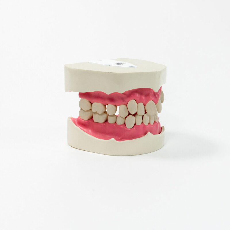 Модель верхней и нижней челюсти для курсов по ортодонтии PD-M ORT — купить в МЕДСЕТ