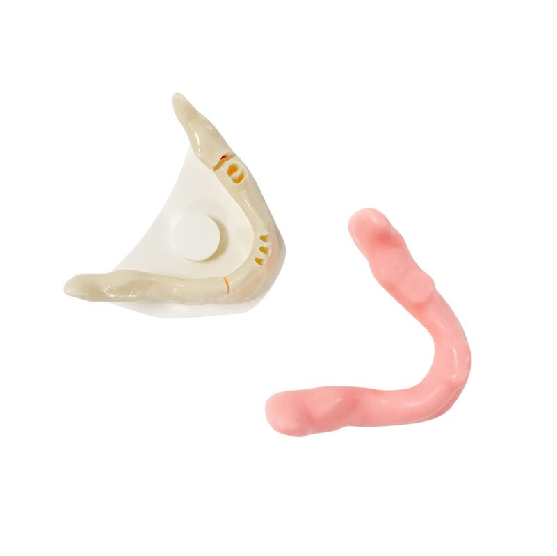 Хирургические модели с переломами — купить в МЕДСЕТ