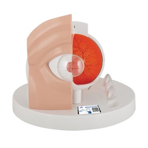 Модель Патологические изменения глаза, в 5-й кратном увеличении — купить в МЕДСЕТ