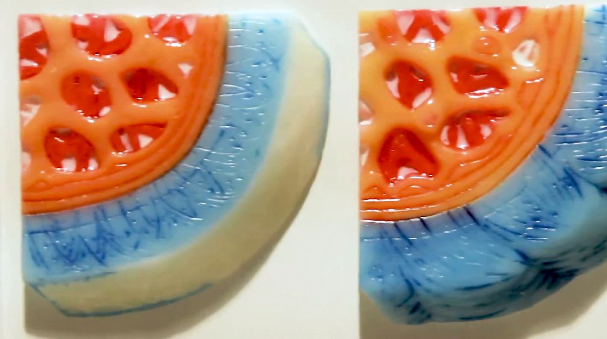 Интерактивный электрифицированный стенд "Заболевания суставов" с натурными образцами — купить в МЕДСЕТ