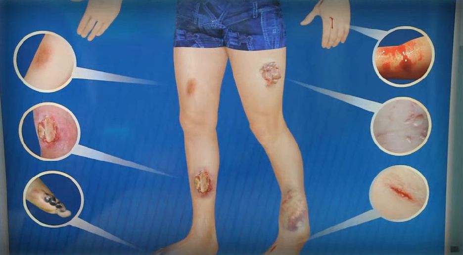 Электрифицированный стенд-тренажер "Травматизм и меры оказания первой помощи" — купить в МЕДСЕТ