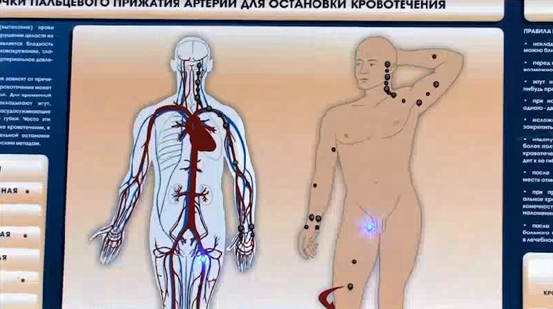 Электрифицированный стенд-тренажер "Остановка кровотечения" — купить в МЕДСЕТ
