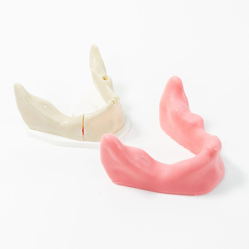 Хирургические модели с переломами — купить в МЕДСЕТ