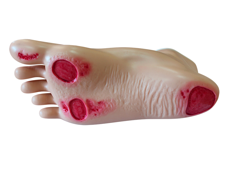 Модель для отработки навыков ухода за диабетической стопой — купить в МЕДСЕТ