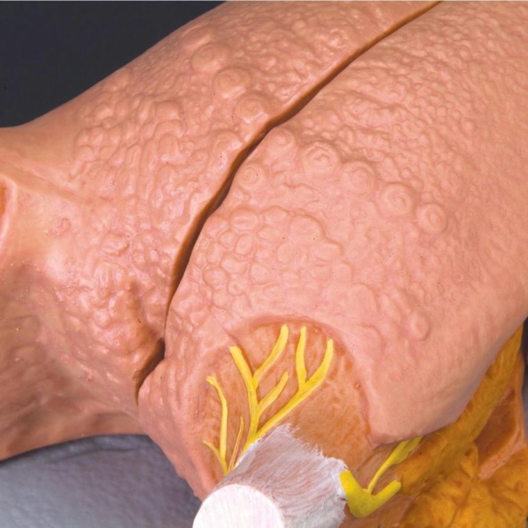 Модель языка — купить в МЕДСЕТ