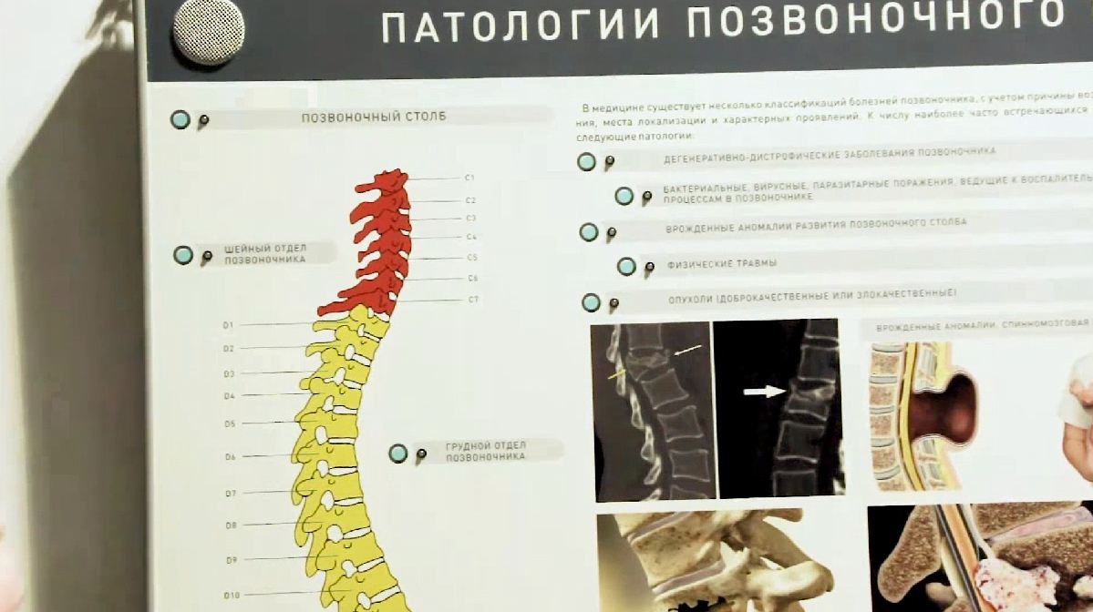 Интерактивный электрифицированный стенд "Патологии позвоночного столба" с натурными образцами — купить в МЕДСЕТ