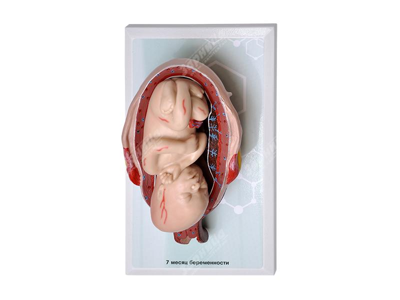 Комплект демонстрационных моделей этапов эмбриогенеза человека — купить в МЕДСЕТ
