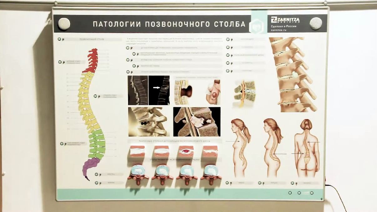Интерактивный электрифицированный стенд "Патологии позвоночного столба" с натурными образцами — купить в МЕДСЕТ