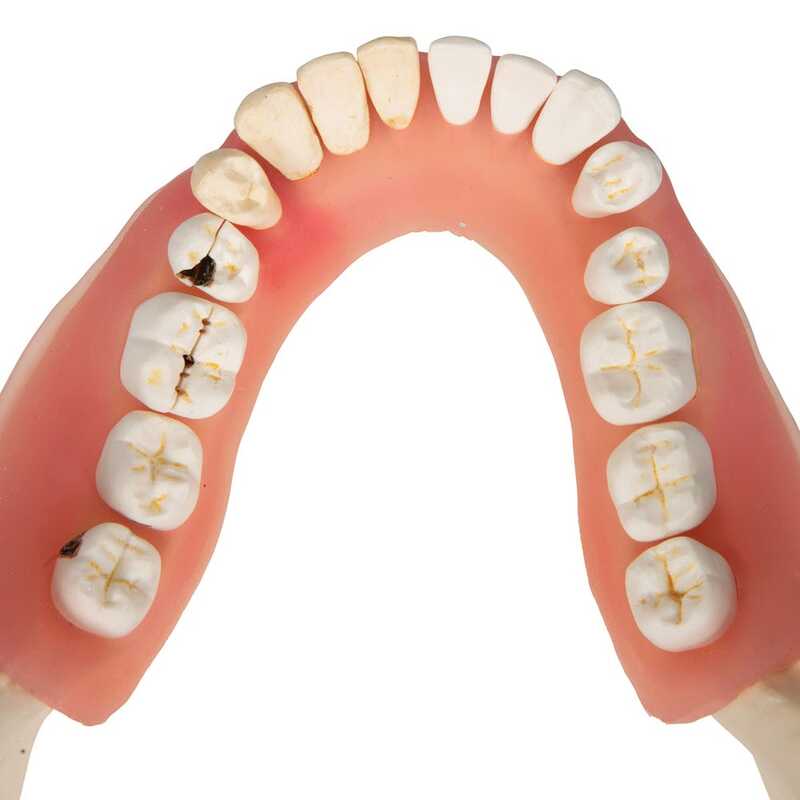 Модель болезней зубов