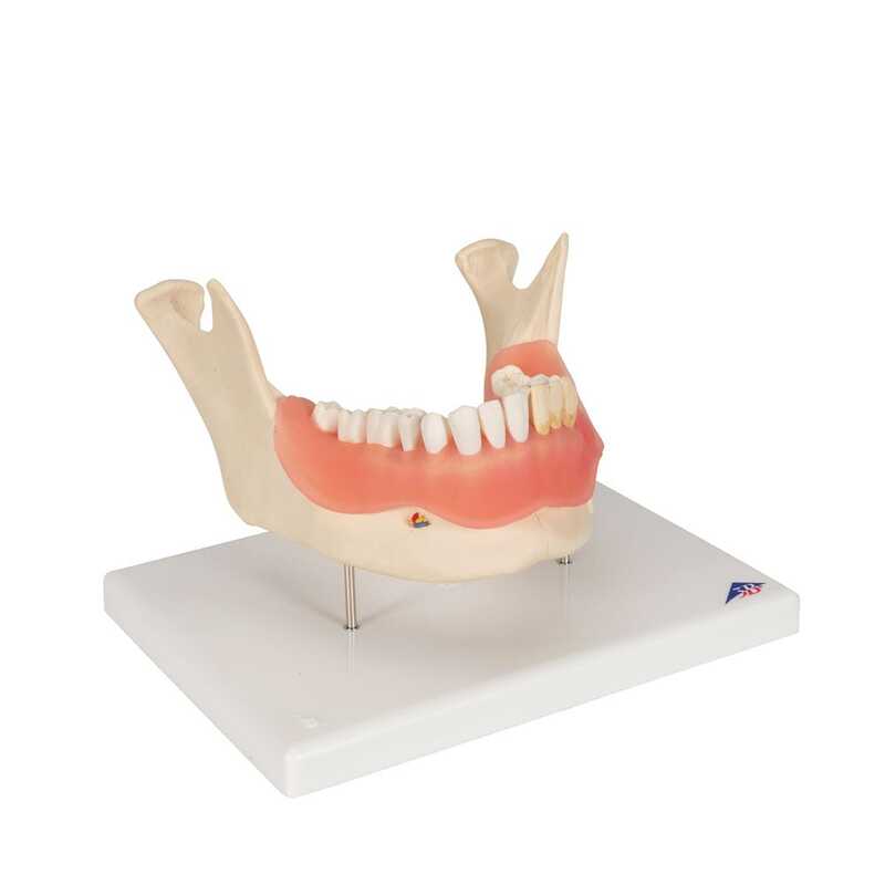 Модель болезней зубов