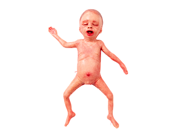 Манекен недоношенного новорожденного — фото