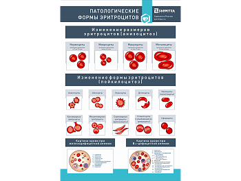Стенд "Патологические формы эритроцитов" — фото