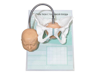 Модель таза с головкой плода на маркерном планшете — фото
