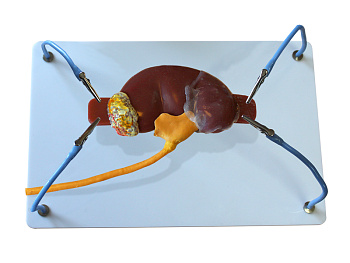 Пособие для отработки навыков лапароскопии "Почка с мочеточником" — фото