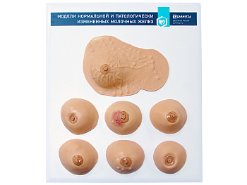 Модели нормальной и патологически измененных молочных желез — фото